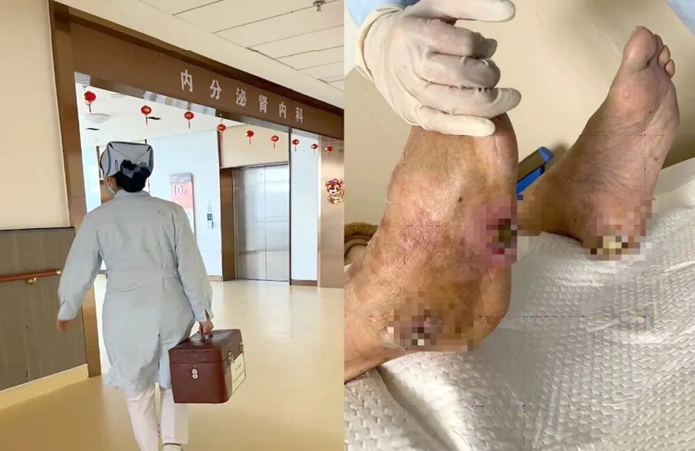 【保山安利醫(yī)院】傷口治療一站式，健康生活零距離！